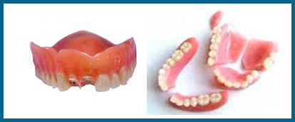 same-day-denture-repairs